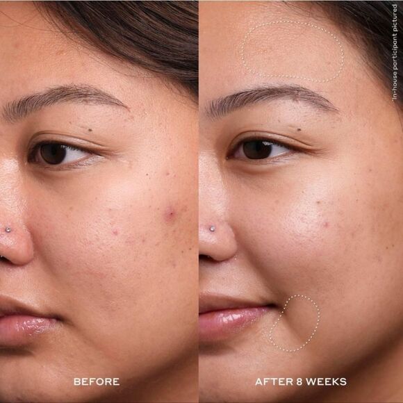 Ole Henricksen Dewtopia 20% Acid Retexturizing Night Serum - Picture 5 of 9